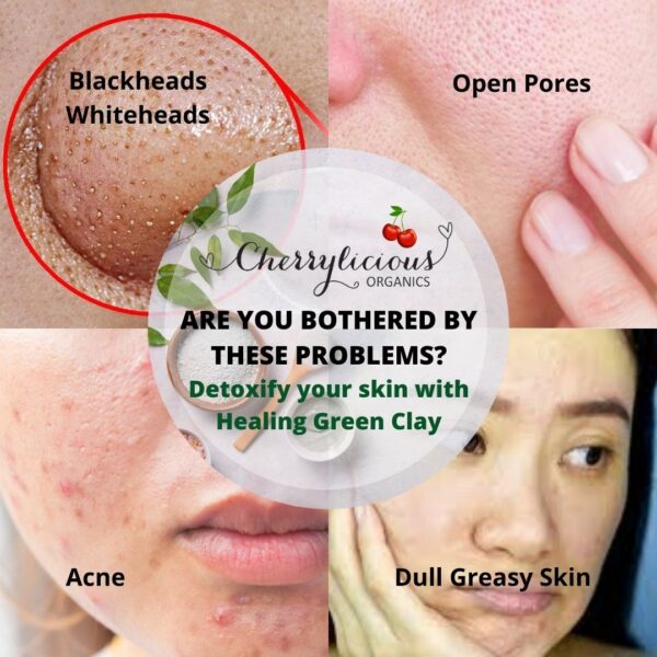 Cherrylicious healing green clay